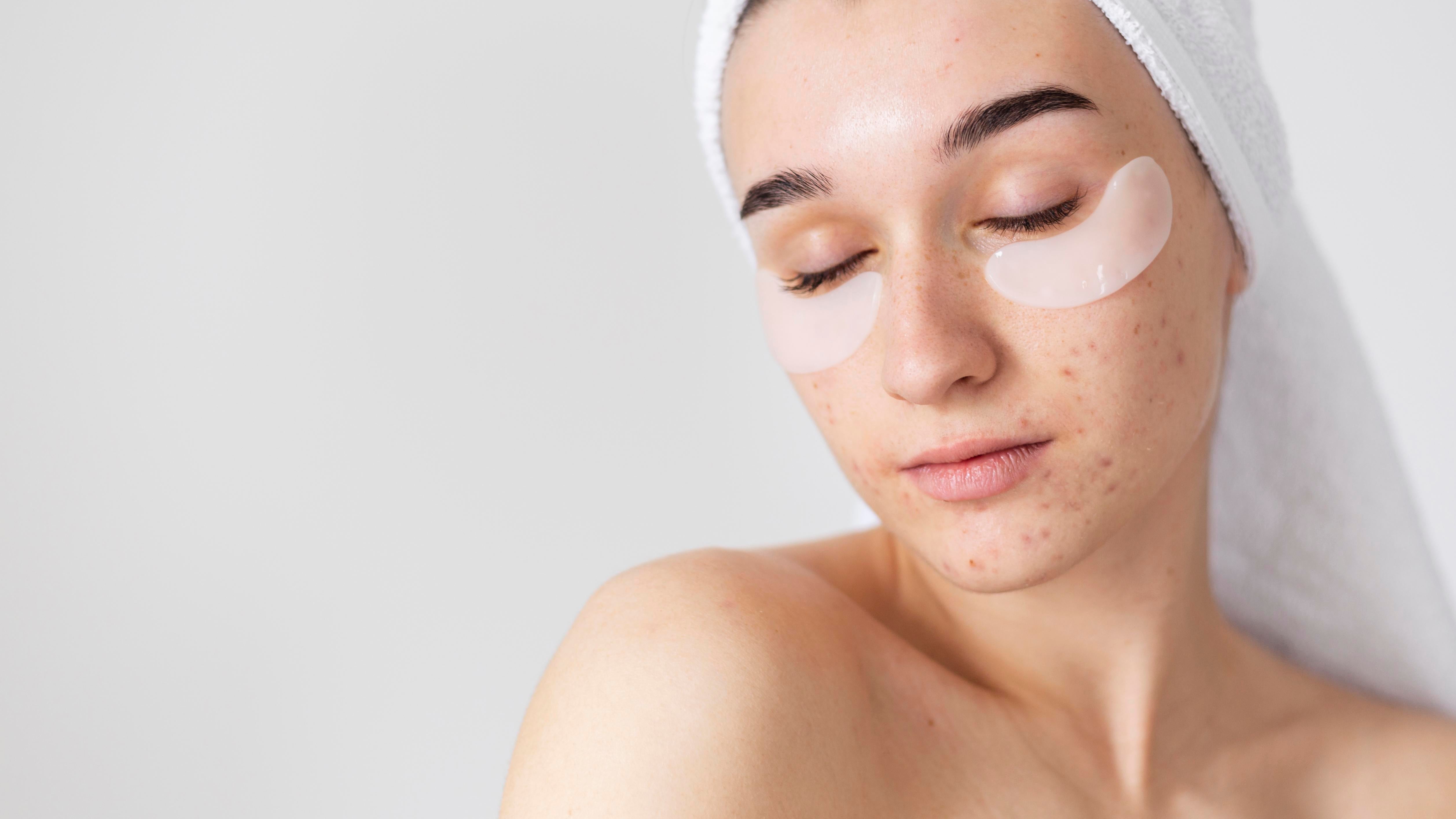 Treat Stubborn Acne at the Source: Seven Unexpected Cases